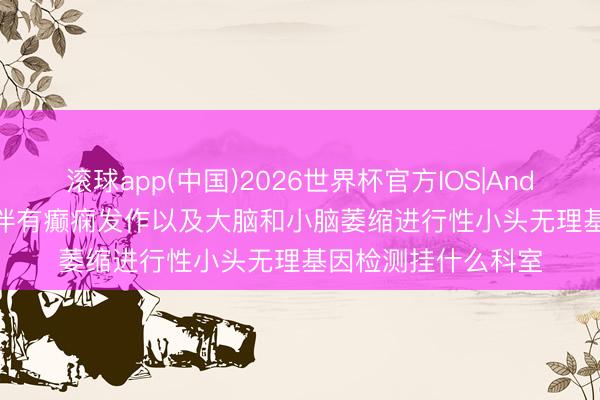 滚球app(中国)2026世界杯官方IOS|Android手机app下载 伴有癫痫发作以及大脑和小脑萎缩进行性小头无理基因检测挂什么科室