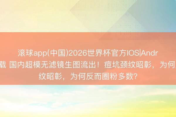 滚球app(中国)2026世界杯官方IOS|Android手机app下载 国内超模无滤镜生图流出！痘坑颈纹昭彰，为何反而圈粉多数？